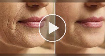 Rub This Sour Spice On Your Face For A Few Minutes — Doctors Are Speechless