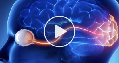 Top Doctor: Do This To Restore 20/20 Vision (Watch Video)