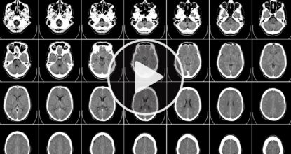 The "Miracle Medicine" Big Pharma Doesn't Want You To Know About