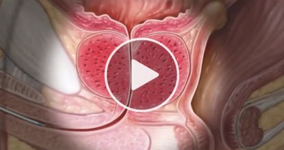 This "Clog" Is The Real Root Cause Of Prostate Problems — One Simple Trick To Fix