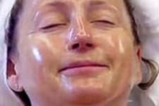 Doctors Stunned: This Removes Wrinkles Like Crazy (Try Tonight)