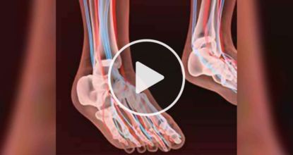 Neuropathy (Nerve Pain)? Do This Immediately (Watch)