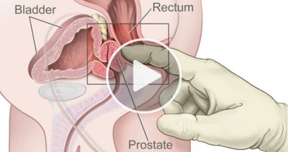 15-Second Male Bedtime Ritual Shrinks Your Prostate In Just Weeks